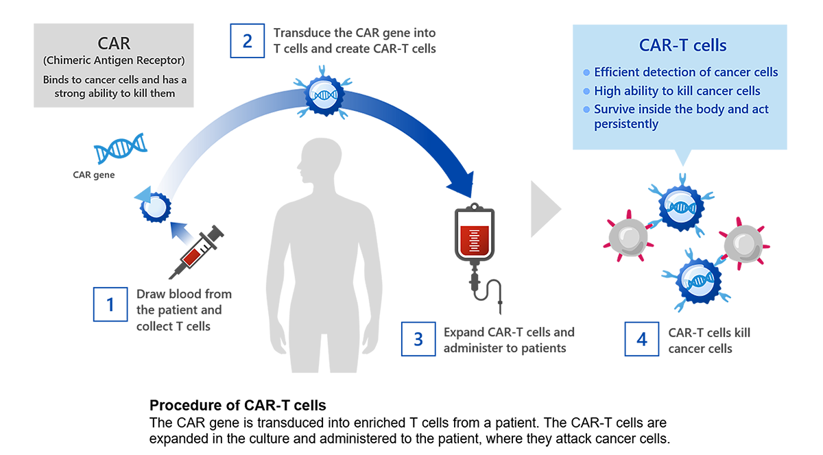CAR-T細胞療法