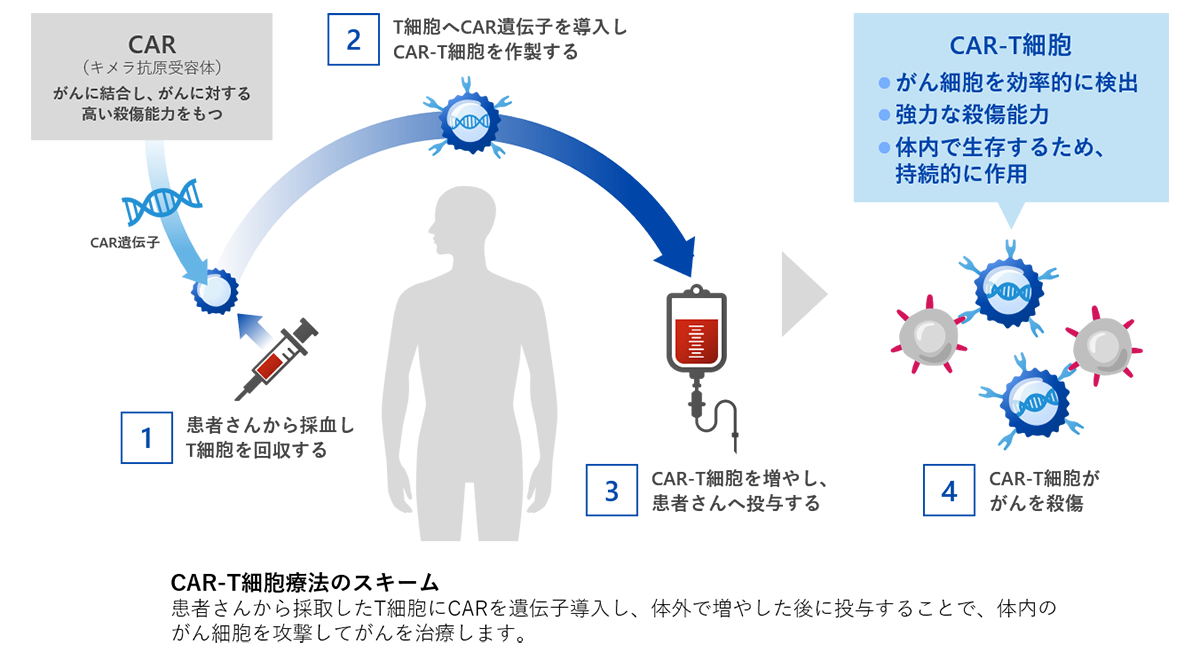 CAR-T細胞療法
